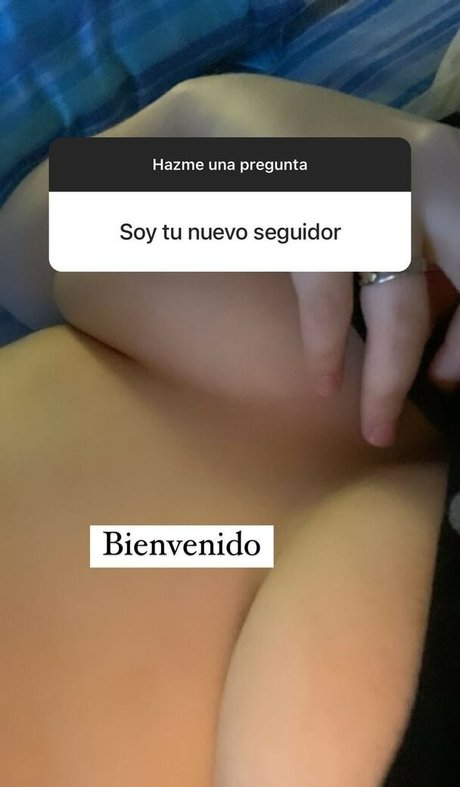 bun1aca